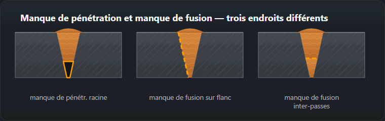 Trois coupes d’une préparation : manque de pénétration à la racine, manque de fusion sur flanc et manque de fusion entre passes